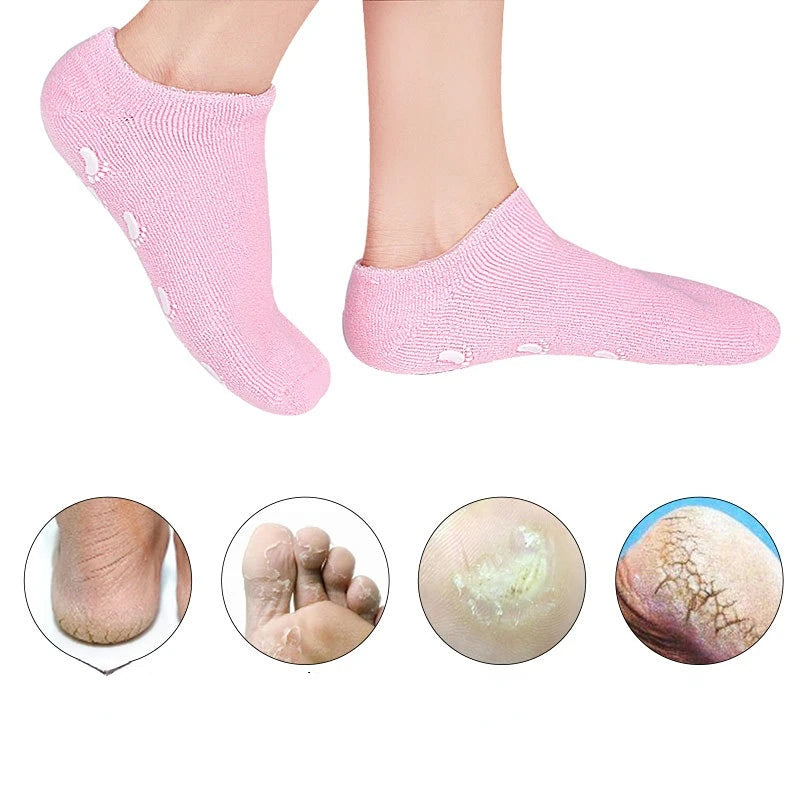 Zaphrosia'S EXFOLIATING GEL SOCKS
